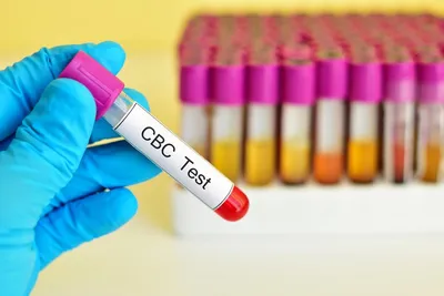 measure red blood cell count with a cbc test