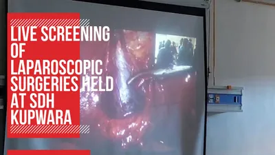 video   live screening of laparoscopic surgeries held at sdh kupwara