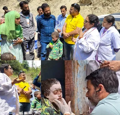 doda  medical team visits village thanalla to address skin disease among children