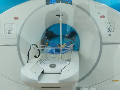 pet scan services commence at gmc jammu