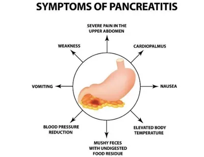 rising cases of acute pancreatitis in kashmir