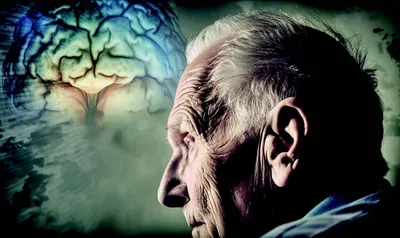 parkinson’s disease dementia  pdd  and alzheimer’s disease  ad 